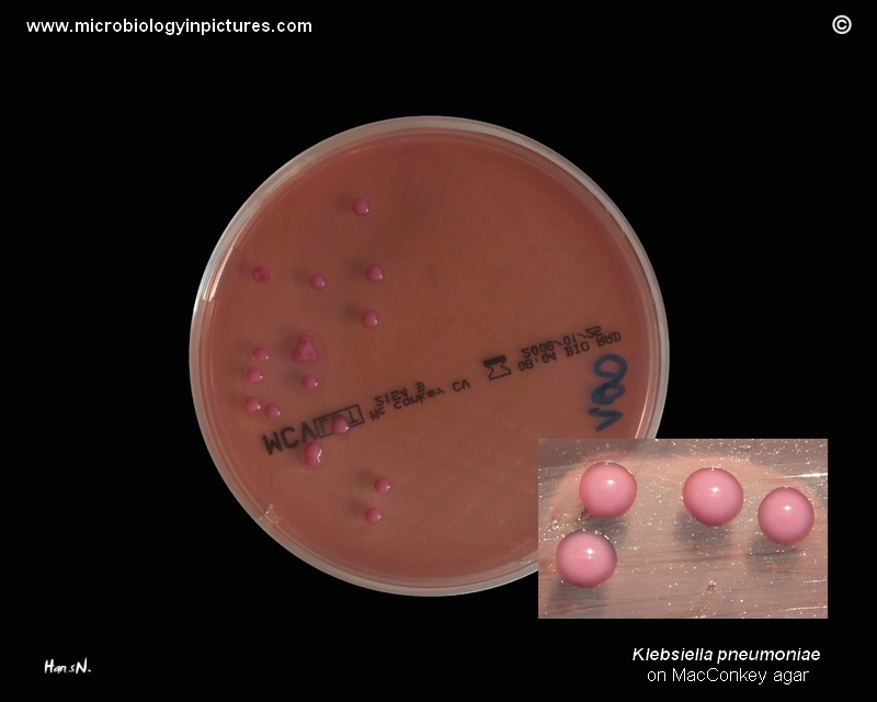 K.pneumoniae on MacConkey